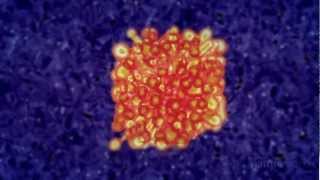 Immunotherapy Boosting the immune system to fight cancer [upl. by Kostival]