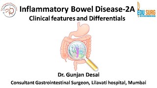 Inflammatory bowel disease  Ulcerative colitis and Crohns disease  Clinical Features Part 1 [upl. by Fairley]