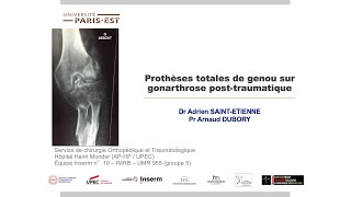 7  PTG sur gonarthrose post traumatique [upl. by Lesde]