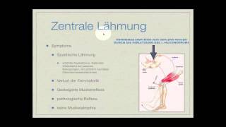 Basiskurs Neurologie Lähmungen Teil 214 [upl. by Siro]