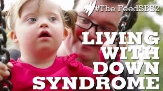 Down Syndrome Life [upl. by Bullough]