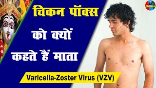 Chickenpox  Monkeypox  Varicellazoster virus  Causes  Signs Symptoms  Treatment चिकन पॉक्स [upl. by O'Reilly]