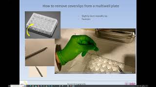 Removing coverslips from a 24 well plate [upl. by Alenson696]