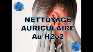 🔵 NETTOYAGE AURICULAIRE AU H2o2 [upl. by Gatian]