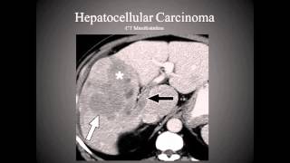 The Hepatobiliary System [upl. by Aierdna]