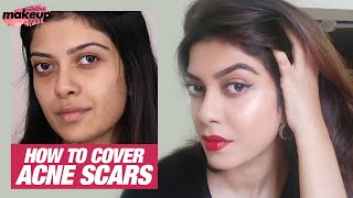 How To Cover Acne Scars amp Pimple Marks With Makeup  Full Coverage Makeup  Makeup 101  Femina [upl. by Arawaj746]