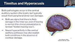 What is Hyperacusis [upl. by Oimetra391]