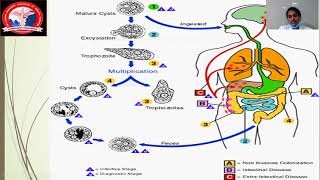 Amoebic Liver Abscess  Dr Janani [upl. by Zedekiah]