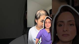 Hair oil for hair growth  dermatologist opines [upl. by Aryek]