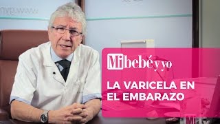 La varicela en el embarazo [upl. by Neerehs]