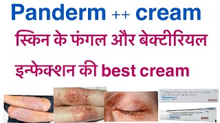 Panderm  cream uses in hindiclobetasol propionate neomycin sulphate amp miconazole nitrate cream [upl. by Goldenberg]