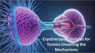 Cryotherapy Principles for Tumors Unveiling the Mechanisms [upl. by Atiuqin]