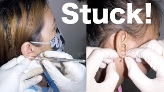 How to Remove Earring Stuck in Mom and Daughters Earlobe [upl. by Kaia]