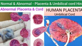 Human Placenta  Structure Function amp Abnormalities of Placenta amp Umbilical cord  Umbilical Cord [upl. by Sharron547]