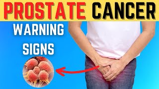 8 Signs of Prostate Cancer in Males [upl. by Yecniuq]