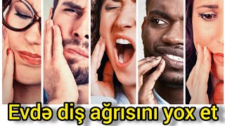 Diş ağrısını nə kəsər Dis agrisini kesmek [upl. by Karole345]