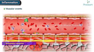 2 Acute Inflammation Vascular Events Animation [upl. by Rhoads]