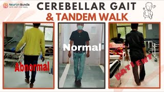 Cerebellar Ataxia Gait Abnormal TandemWalk neurology widebasegait tandemgait meded [upl. by Riess]