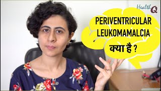 PERIVENTRICULAR LEUKOMALACIA KYA HAI [upl. by Mulvihill34]