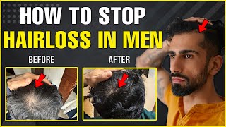 Best HAIR LOSS Treatments For Men Guaranteed Results [upl. by Garald]