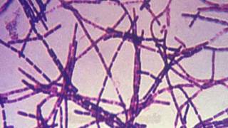 Anthrax and Bacillus anthracis [upl. by Macri]