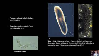 BIOL 1407 Lab 37 Platyhelminthes [upl. by Gamber]