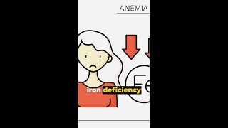 Iron Deficiency Anemia Causes amp Solutions shorts [upl. by Gus]