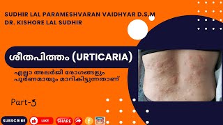 ​ ശീതപിത്തം URTICARIA എല്ലാ അലർജി രോഗങ്ങളും മാറികിട്ടുന്നതാണ് [upl. by Canute349]