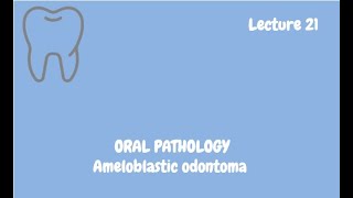 Ameloblastic odontoma Complete Lecture  For NBDE NDEB MDS amp FCPS [upl. by Shaw]