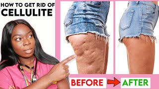 How to get rid of CELLULITE on your THIGHS LEGS amp BUTT Home Remedies Workout  Creams amp more [upl. by Naasar]