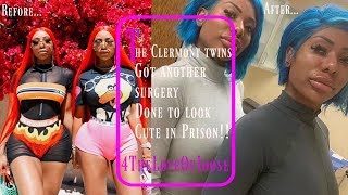 The Clermont Twins get BIGGER LIPS before prison [upl. by Nnasor]