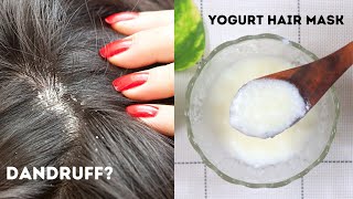 Yogurt Hair Mask  Dandruff Removal Treatment at Home  Yogurt For Dandruff [upl. by Raeann]