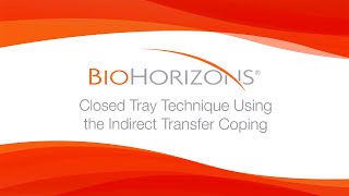 Closed Tray Technique Using the Indirect Transfer Coping [upl. by Dierolf]