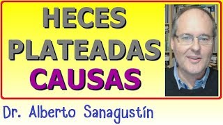 HECES PLATEADAS ▶ ¿Sabes las Causas [upl. by Converse105]