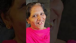 പല്ല് വെറുതെ പറിച്ചുകളയല്ലേ dentalvideos dentalclinic dentalcare dentist thedentalviews [upl. by Azil]