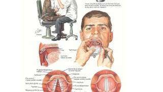 ORL DIAGNOSTIC D’UNE DYSPHONIE [upl. by Ecam]