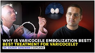 Varicocele  Nonsurgical treatment of Varicocele  Varicocele embolization  Dr Gaurav Gangwani [upl. by Jacquetta]