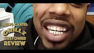 BlingCartelcom Grillz Review [upl. by Gorlicki]