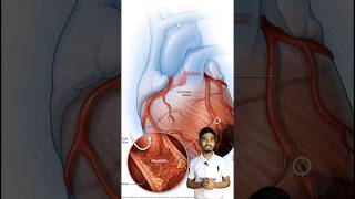 Amlodipine Tablet  Uses of Amlodipine Tablet [upl. by Htes]