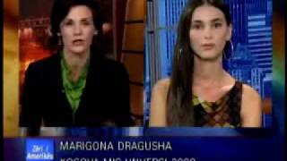 Interviste me Mis Kosova Univers Marigona Dragusha [upl. by Ball572]