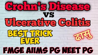 Crohns Disease vs Ulcerative Colitis Tricks  Mnemonic  Neet Pg  Fmge Special [upl. by Far398]