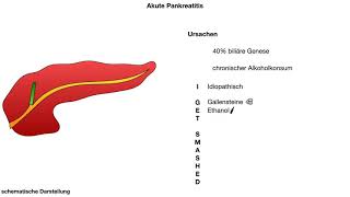 akute Pankreatitis  Ursachen wwwclipdocsde [upl. by Palma65]