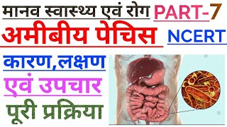 अमीबिएसिस या अमीबीय पेचिश।। What is amoebiasis or amoebic dysentery in Hindi Biology [upl. by Charpentier]