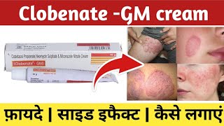 Clobenate gm cream ke fayde  Clobenate gm cream kis kaam aati hai  Clobenate gm cream uses [upl. by Sanjiv]