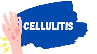 Cellulitis Skin Infection  Treatment erysipelas [upl. by Genisia259]