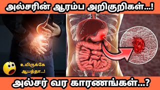 Ulcer symptoms in tamil  அல்சர் ஆரம்ப அறிகுறிகள்  வர காரணம் alsar arikurigal in tamil ulcer tips [upl. by Fredel148]