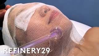 High Frequency Facial For Clear Skin  Beauty With Mi  Refinery29 [upl. by Ikkaj]