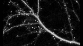 Synaptic development of cultured rat neuron [upl. by Giuseppe]