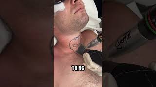 How Exactly Does Laser Tattoo Removal Actually Work 📸 lasertat [upl. by Akinnor]