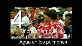 Testimonios omnilife video 004 riñon hemodiálisis agua pulmones [upl. by Ariec568]